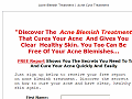 Acne Blemish Treatment